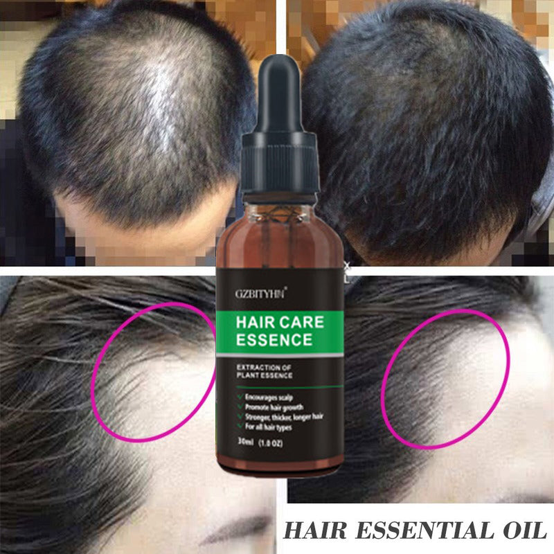 Rosemary Hair Growth Oil