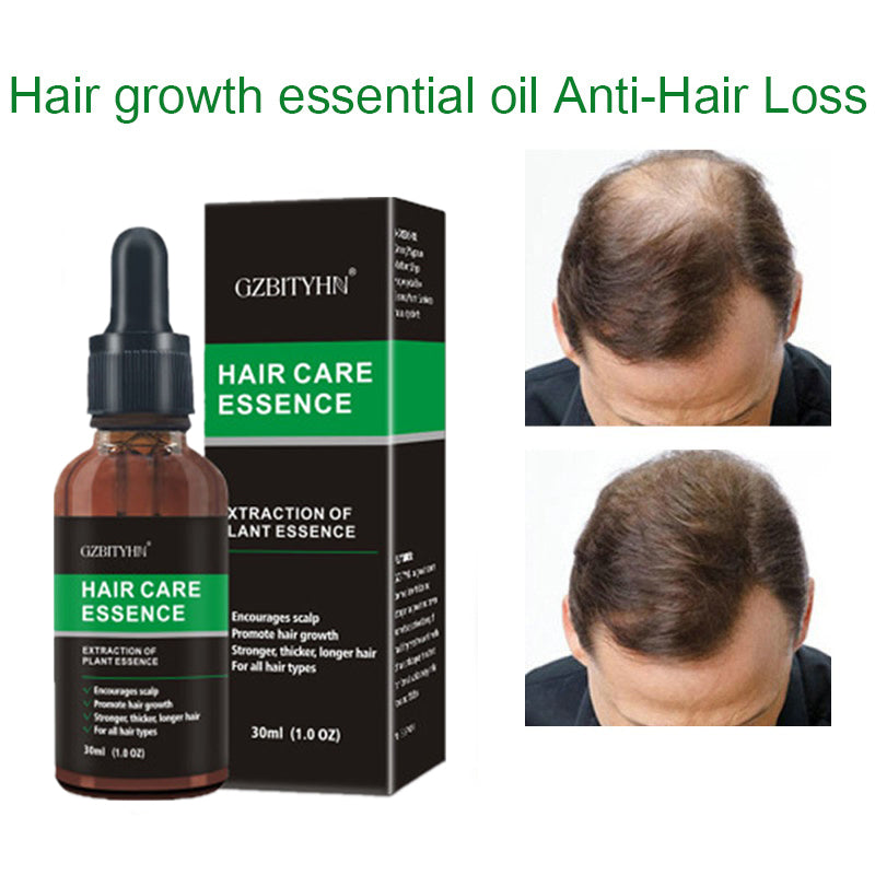 Rosemary Hair Growth Oil